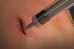 MeTro Glue / Image: University of Sydney