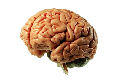 Human Brain / Image: iStockPhoto