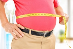 Trodusquemine alleviates symptoms of atherosclerosis. / Image: ABDN