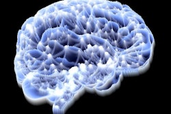 Brain Imaging / Image: PASIEKA Getty Images