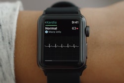 KardiaBand / Image: AliveCor