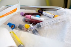 Cancer Test / Image: Getty Images
