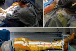 Augmented Reality in the operating theater. / Image: Philip Pratt