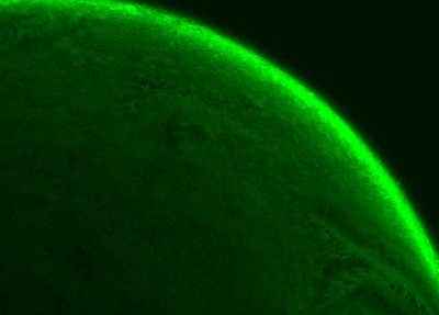 The distribution of chitosan over a mucin drop is shown in flourescence. Image: Thomas Crouzier