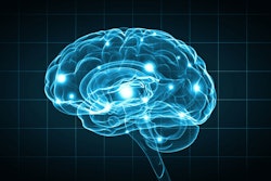 Brain on Opioids