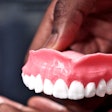 3-D Printed Dentures Deliver Drugs / Image: Douglas Levere/U. Buffalo)