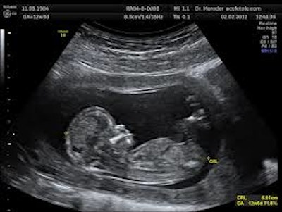 Ultrasound / Image: WIkipedia