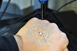 Temporary 3D-Printed Electronic / MCALPINE GROUP/UNIVERSITY OF MINNESOTA