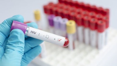 Hopeful HIV Vaccine / Image: Getty