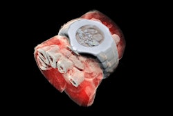 3D Color X-Ray Image / Image: Mars Bioimaging