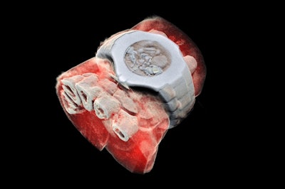 3D Color X-Ray Image / Image: Mars Bioimaging