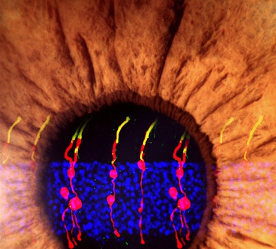 Researchers have discovered a way to reverse congenital blindness in mice by generating rod photoreceptors. / Image: NIH