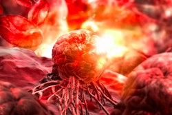 Tumor / Image: Getty