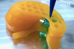 3D Printed Organ / Image: Cellink