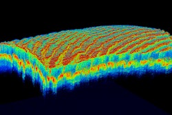 Optical coherence tomography angiography / Image: medgadget