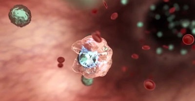 HIV Invected Cell / Image: Zion Pharma