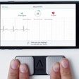 ECG App / Image: IMCHI