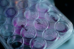 Cancer Cells in a Tray / Image: Suzanne Plunkett