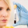 HDA’s response to FDA’s Draft on DSCSA Product Identifiers identifies lack of time to respond. GTIN or NDC identifier, human-readable expiration date format also pose concerns.