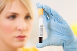 HDA’s response to FDA’s Draft on DSCSA Product Identifiers identifies lack of time to respond. GTIN or NDC identifier, human-readable expiration date format also pose concerns.