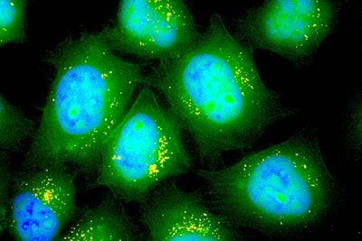 Green fluorescent proteins in lung cells. / Image: Asha Patel