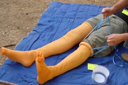 HemaShock / Image: OHQ Medical Devices
