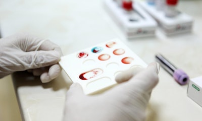Screening Blood for Cancer / Image: Zoonar GMBH Halamy