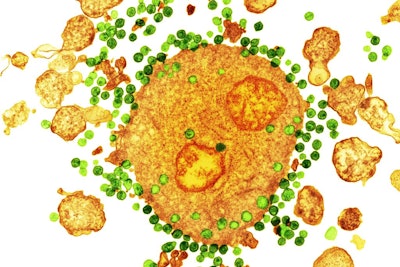 HIV Virus / Image: NIBSC