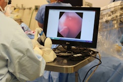 Catheter View / Image: Fagogenis