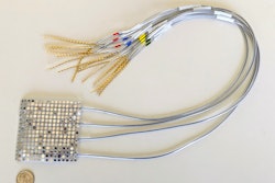 Prosthetic Voice / Image: UCSF