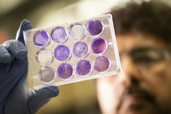 Vaccines stored in sugar film. / Image: JD Howell