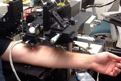 Cancer-Seeking Laser / Image: E.I. Galanzha