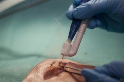 Sniffing for Cancer / Image: Tampere University