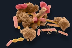 Bacteria from human feces / Image: Getty Images