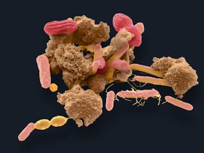 Bacteria from human feces / Image: Getty Images