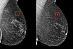Breast Exam / Image: TechCrunch