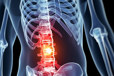 Spine Injury / Image: Michigan Engineering