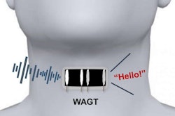 Wearable Throat Device / Image: Artificialth