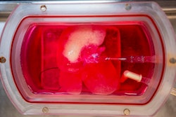 Mini Liver / Image: UPMC