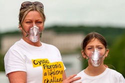 Cystic Fibrosis / Image: Shutterstock
