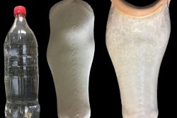 Prosthetic made from plastic bottles. / Image: DMU