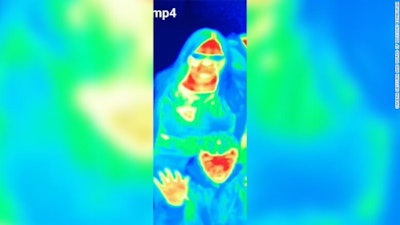Tourist Attraction Thermal Camera Spots Breast Cancer