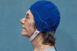 MemorEMTM / Image: NeuroEM