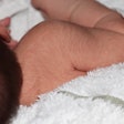 Infant Werewolf Syndrome / Image: Shutterstock