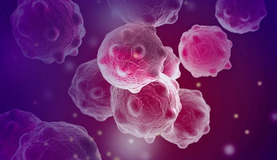 Cancer Therapy / Image: Adobe Stock