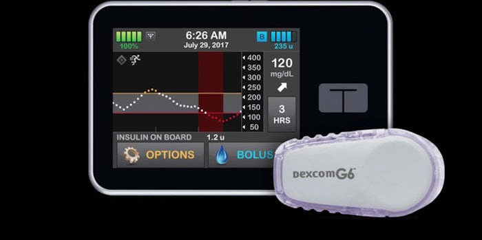 Artificial Pancreas