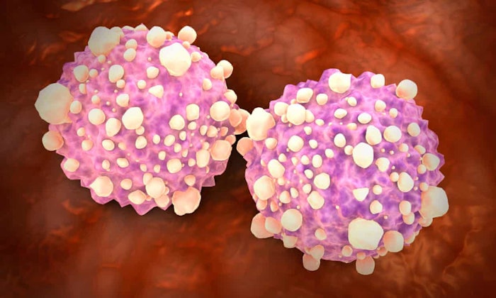 Pancreas Cancer Cells