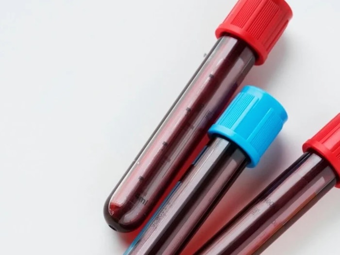Blood Tests