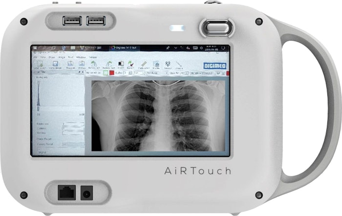 AiRTouch Portable X-Ray