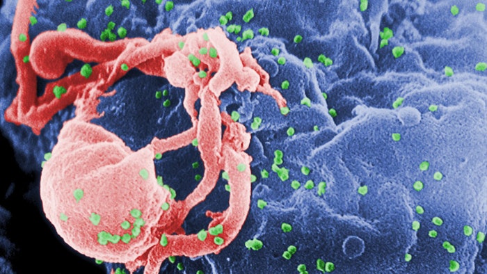 HIV Virus
